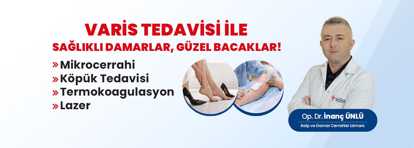 Varis Tedavisi ile Sağlıklı Damarlar Güzel Bacaklar